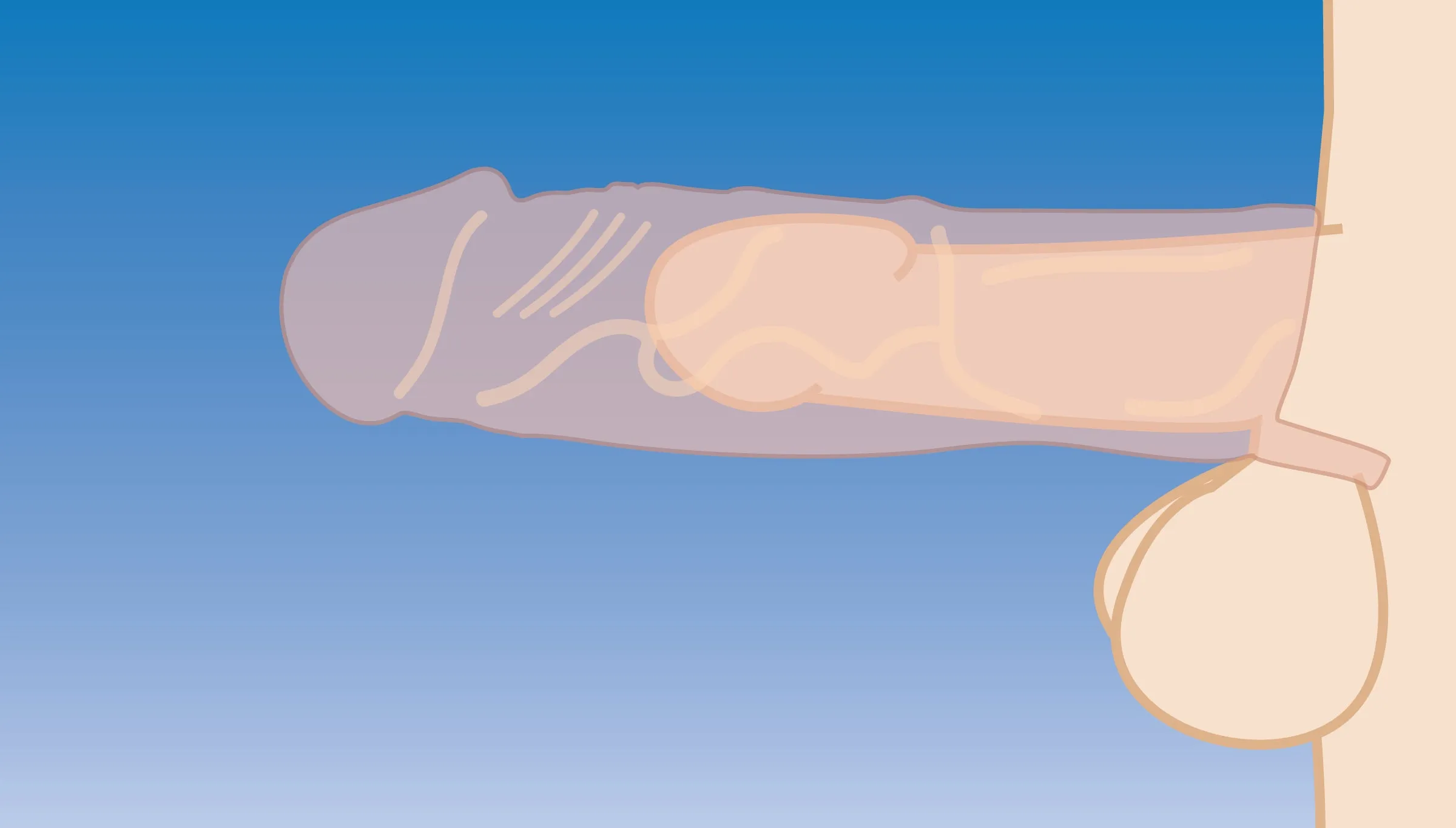 Erection Enhancer - 2 Inch